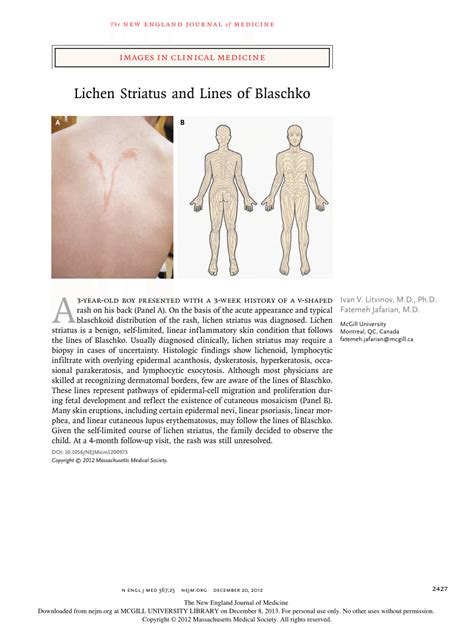 (PDF) Images in clinical medicine. Lichen striatus and lines of Blaschko