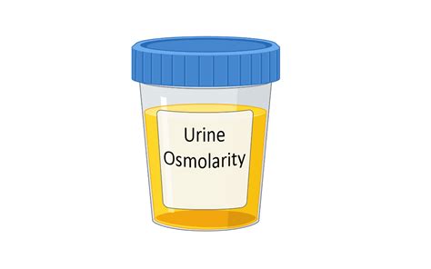 Measurement of Urine and Plasma Osmolality » Clinical Laboratory Science