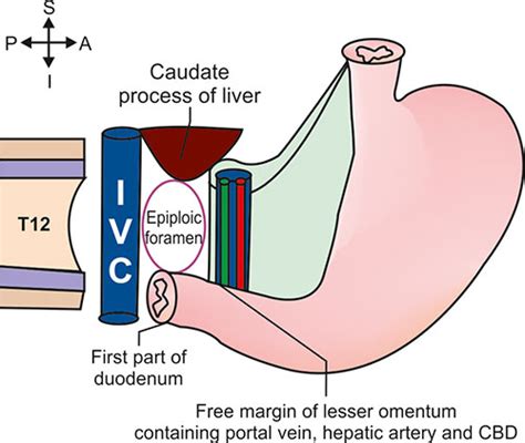 Omental Foramen Boundaries