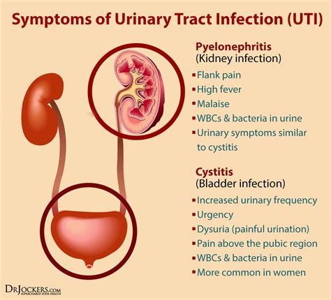 5 Phases to Support Urinary Health Naturally - DrJockers.com