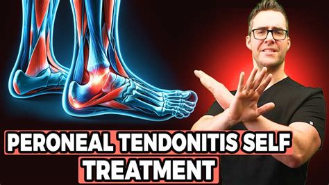 Peroneal Tendonitis Self Treatment [Stretches, Exercises & Massage ...