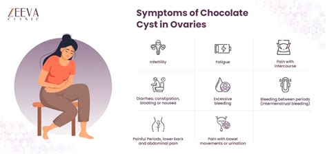 Chocolate Cyst in Ovaries- Symptoms, Diagnosis, Treatment, Care