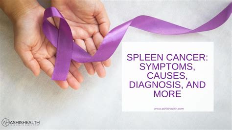 Spleen Cancer: Causes, Diagnosis, Symptoms and Treatment