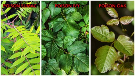 Poison Sumac Rash