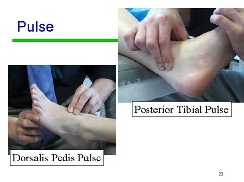 Dorsalis Pedis Pulse / Arteries And Veins Of The Lower Limb Dr | Melissa Fack1943