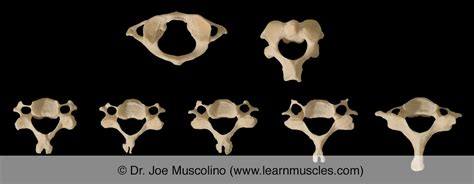 Cervical Vertebrae - Learn Muscles