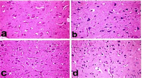 (a), Brain showing normal (control). H&E X400. (b), Brain showing... | Download Scientific Diagram