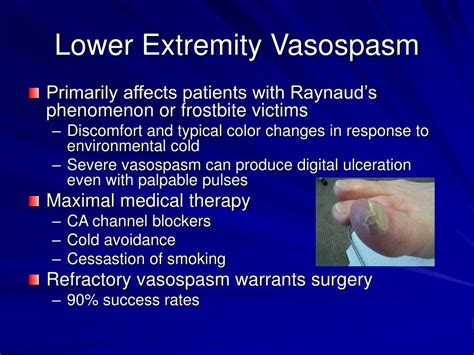 PPT - Lumbar Sympathectomy: Indications & Techniques Chapter 85 PowerPoint Presentation - ID:261637