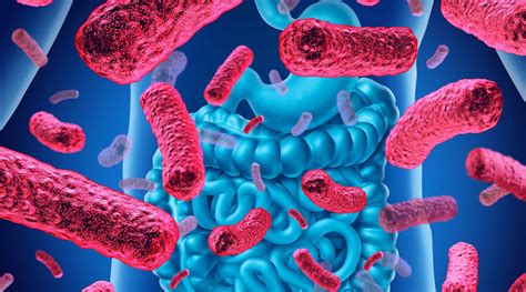 Early gut bacterial colonization may help prevent eczema, research shows