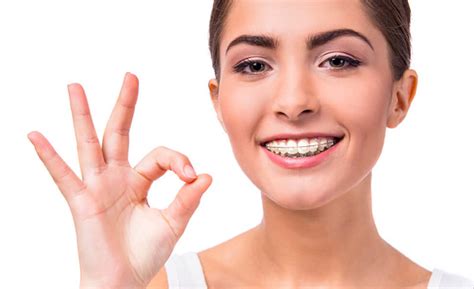 The Pros and Cons of Ceramic Braces - Elegant Dental Care