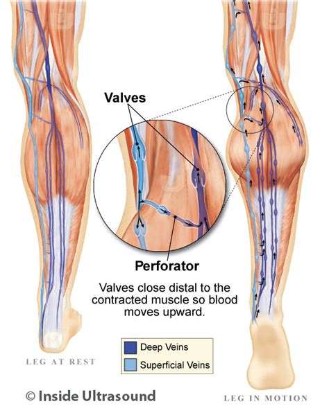 Venous Valves - Inside Ultrasound