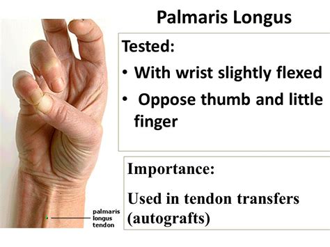 Palmaris Longus Test