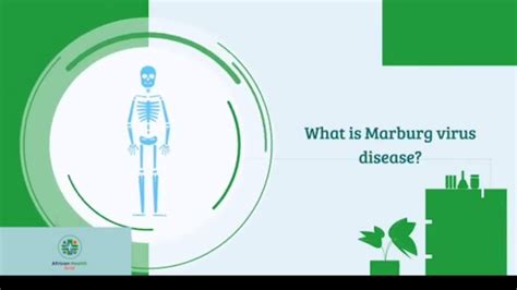 Marburg Virus Disease (MVD); What is MVD? Outbreak, Prevention ...