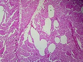 Human, Lung Showing Alveoli - Microscope Slide: Amazon.com: Industrial & Scientific