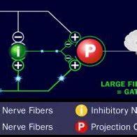 Melzack and Wall's Gate Control Theory of Pain (1965). Reproduced from ...