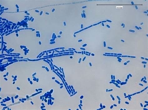 Geotrichum candidum ~ Everything You Need to Know with Photos | Videos