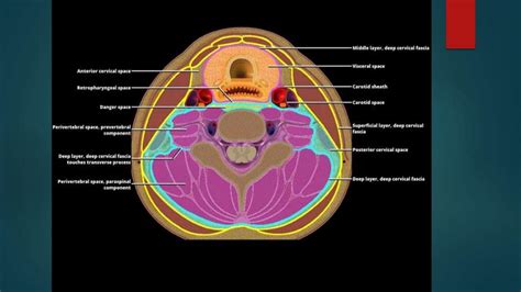 Anatomy of neck spaces