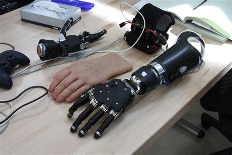 Researchers Map Brain Activity to Improve Prosthetic Design - Medical ...