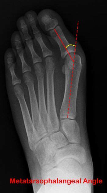 Pin on Usmle