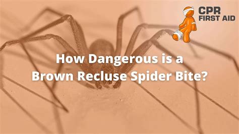 Brown Recluse Spider Bite Brown Recluse Spider Bite,, 44% OFF