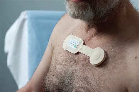 Wearable ECG And Other Smart Medical Accessories