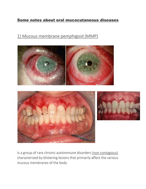 (PDF) Literature Review - Oral Mucocutaneous Diseases