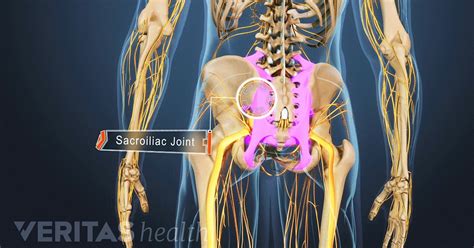 Ankylosing Spondylitis Surgery | Arthritis-Health