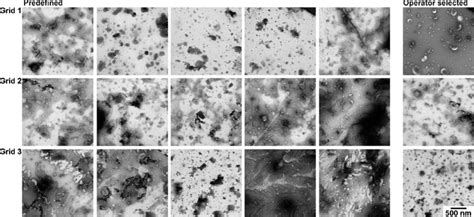 TEM images obtained with protocol D. TEM images obtained after operator... | Download Scientific ...