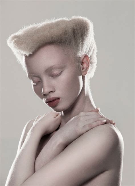 Stunning Photos Of Models With Albinism Capture The Beauty In Breaking Convention | HuffPost