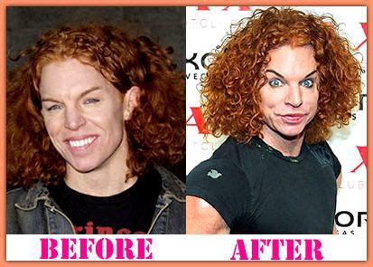 'OZ' - The 'Other' Side of the Rainbow: Carrot Top - Before and after