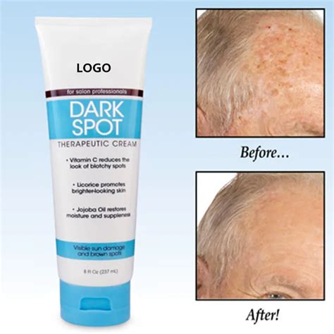 Best Dark Spot Wrinkle Remover Cream For Face And Body - Buy Dark Spot Cream,Dark Spot Cream For ...