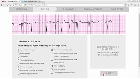 ACLS Precourse ECG Rhythm - YouTube