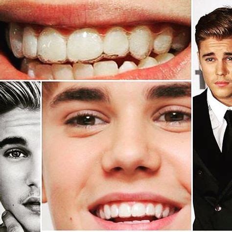 Did you know Justin Bieber chose Invisalign to straighten his teeth? It ...