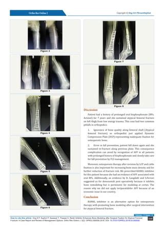 Rankl Inhibitor Enhances Bone Modeling after Surgical Fixation for Atypical Femoral Fracture: A ...