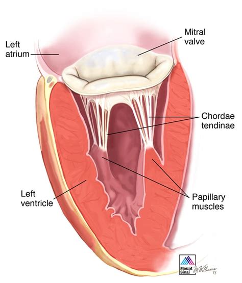 Papillary Muscles and the Left Ventricle | Mitral Valve Repair Center