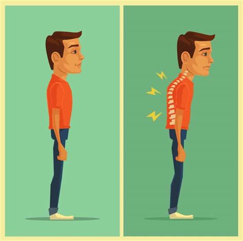 Bad Posture - Effects, Causes, & Fixes - The Bodywise Clinic