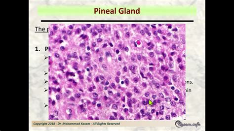 Pineal Gland Histology Labeled