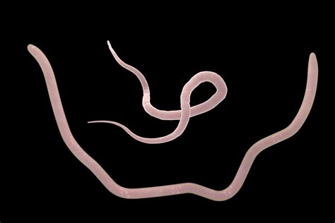 Roundworms in Horses - Symptoms, Causes, Diagnosis, Treatment, Recovery, Management, Cost