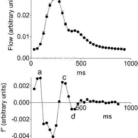 Representative photoplethysmogram waveform (top) and its second ...