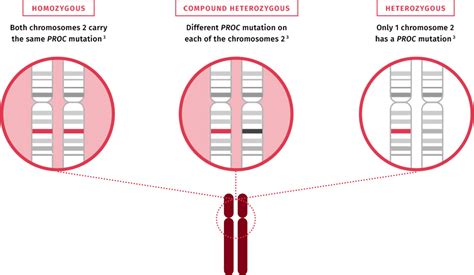 Genetics of SCPCD – hereditary mutations