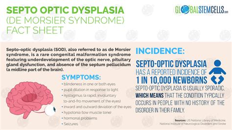 Stem Cell Therapy – Answer to s Septo-optic Dysplasia Symptoms | GSC