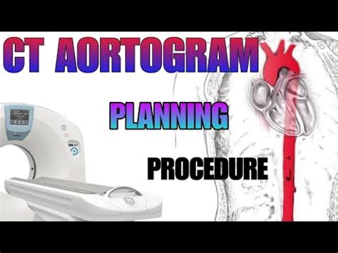 CT AORTOGRAM : planning and procedure explained - YouTube