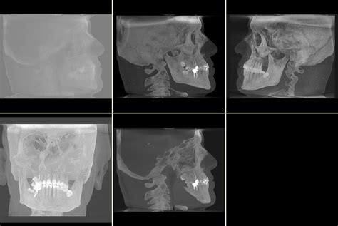 Large Volume CBCT - Dental Scanning - Cavendish Imaging Ltd