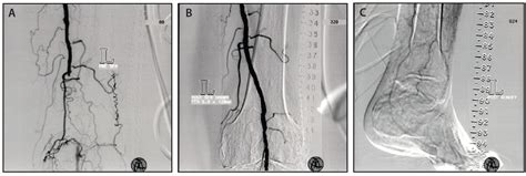 sfa abbreviation medical