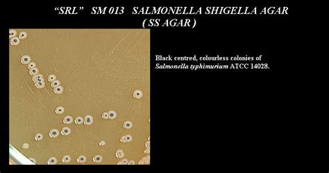 SS Agar (Salmonella Shigella Agar) | Dehydrated Culture Media