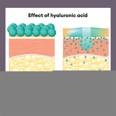 Hyaluronic acid: A popular anti-aging agent | Cosphatec