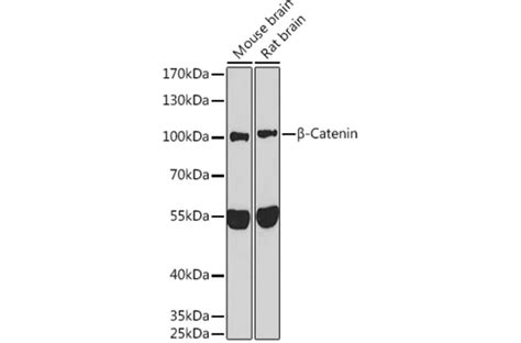 Anti-beta Catenin Antibody (A80413) | Antibodies.com