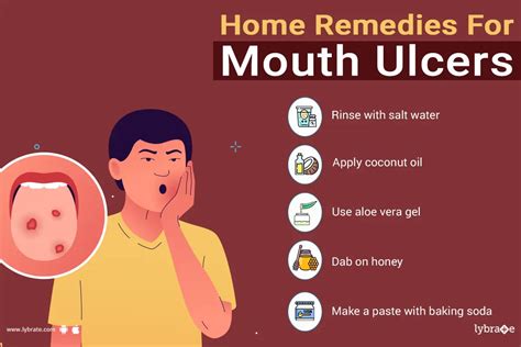 Home remedies for mouth ulcers - By Dr. Bindiya R Patel | Lybrate