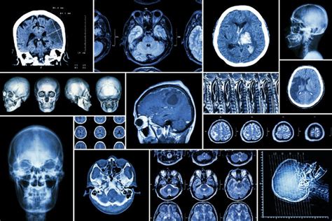 83% of Medical Imaging Devices Run on Unbacked Operating Systems