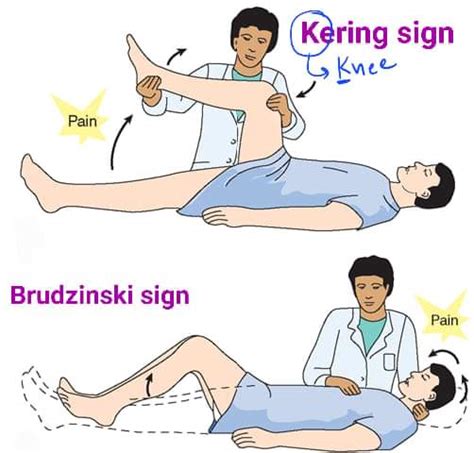 Kernig Sign, Brudzinski Sign, How To Perform Kernig And, 48% OFF